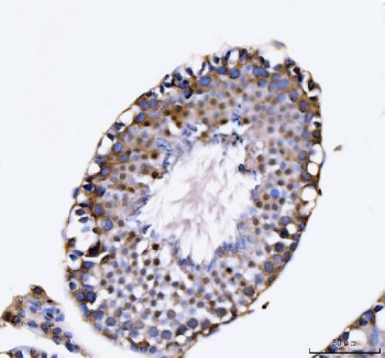 Anti-KIFC1