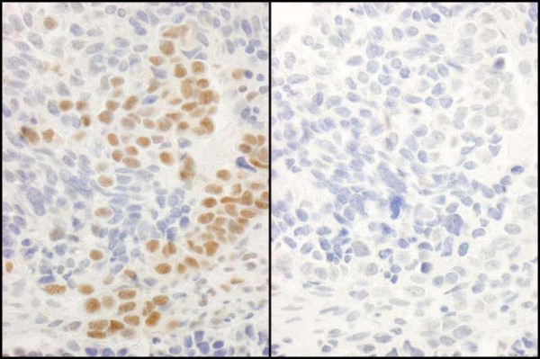 Anti-phospho-RelA (Ser536) (IHC)