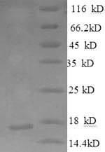 Neurofascin (NFASC), partial, human, recombinant