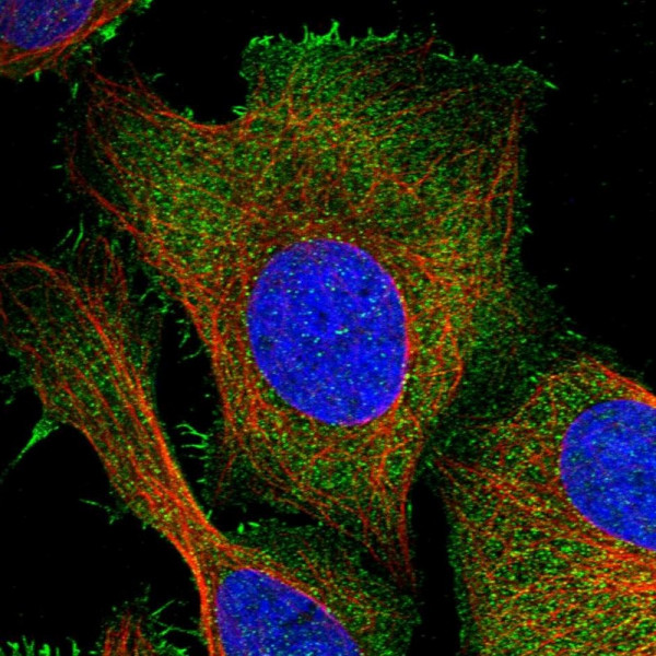 Anti-PKD2L2