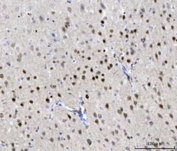 Anti-CHD1 / Chromodomain-helicase-DNA-binding protein 1