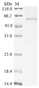 Ras-related protein Rab-12 (RAB12), human, recombinant