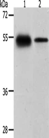 Anti-CA14