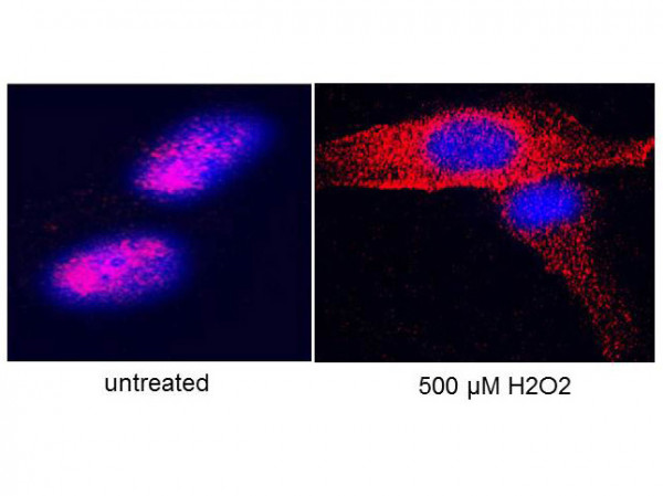 Anti-Telomerase (hTERT Catalytic Unit)