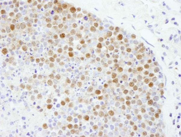 Anti-Fen1 (IHC)