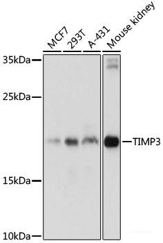 Anti-TIMP3