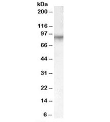 Anti-Factor XIIIa
