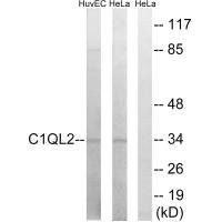 Anti-C1QL2