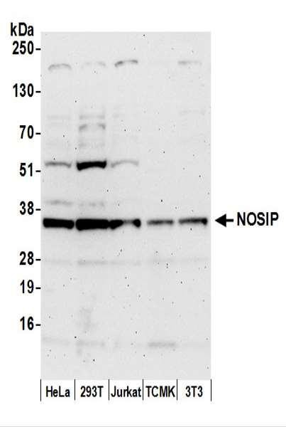 Anti-NOSIP