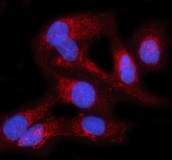 Anti-PRAG1 / Pragmin / PEAK1-related kinase-activating pseudokinase 1