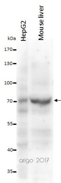 Anti-alpha Fetoprotein