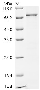 Methyltransferase-like protein 25 (METTL25), human, recombinant
