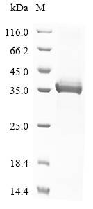 Ectonucleotide pyrophosphatase/phosphodiesterase family member 1 (Enpp1), partial, mouse, recombinan