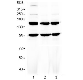Anti-VEGF Receptor 3 / VEGFR3