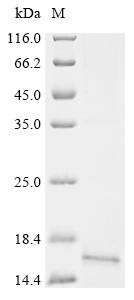 Cathelicidin antimicrobial peptide (CAMP), partial, recombinant Pan troglodytes