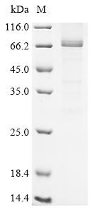 Serine/threonine-protein kinase RIO3 (RIOK3), human, recombinant