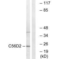 Anti-CYB561D2