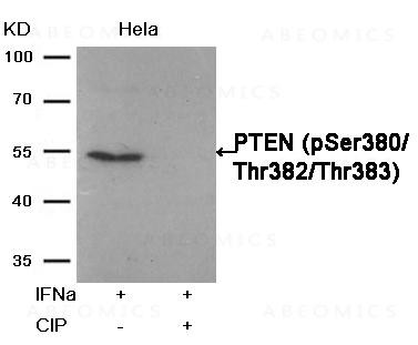 Anti-phospho-PTEN (Ser380/Thr382/Thr383)