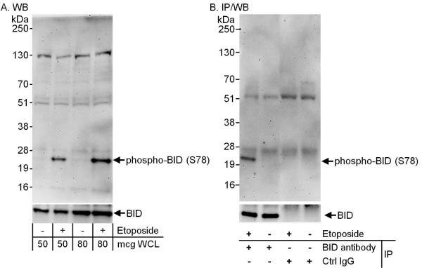 Anti-phospho-BID (Ser78)