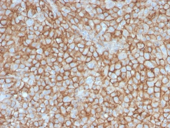 Anti-CD146 / MCAM / MUC18, clone MCAM/3046