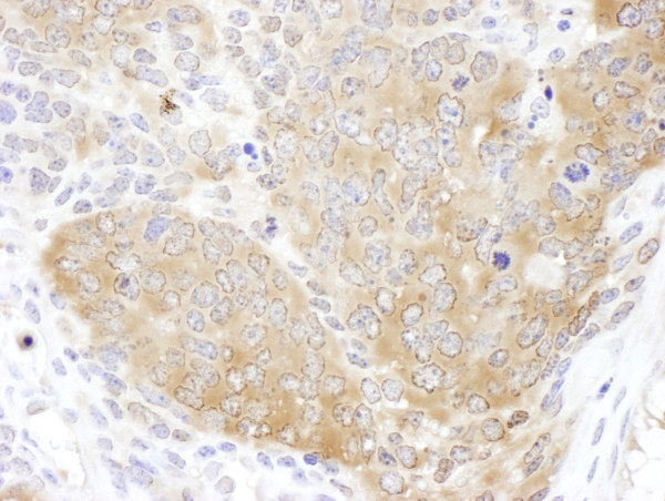 Anti-CCT5