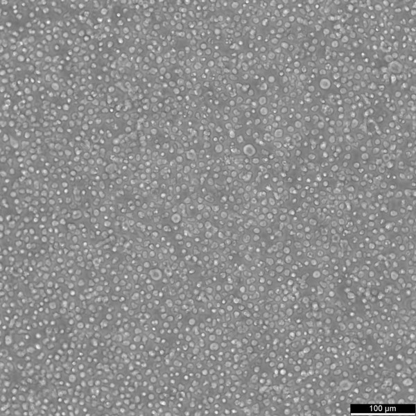 Namalwa Cells