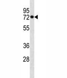 Anti-HSPA1L