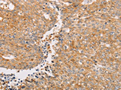 Anti-PACSIN2