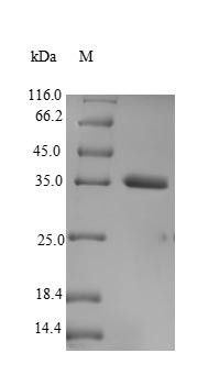 Transcription cofactor vestigial-like protein 3 (VGLL3), human, recombinant