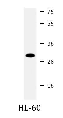 Anti-RPS4X / SCAR