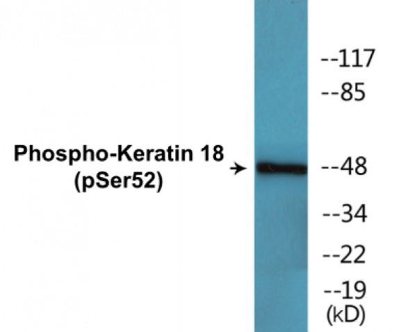 Keratin 18 (Phospho-Ser52) Colorimetric Cell-Based ELISA Kit
