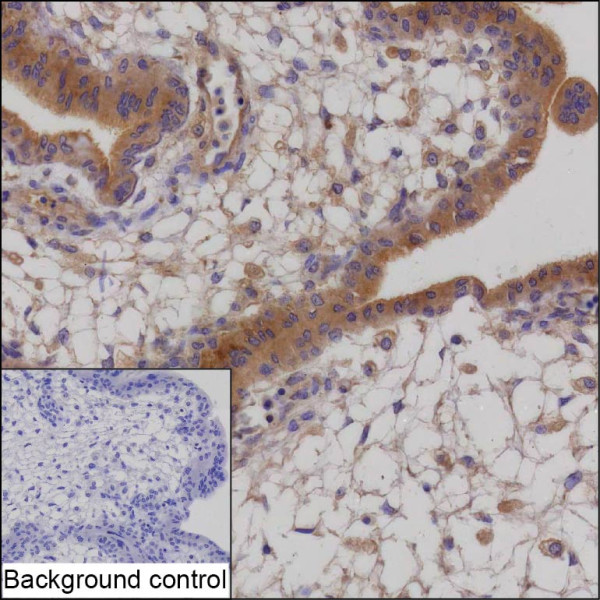 Anti-CCN2 (recombinant antibody)