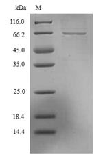 Nucleoprotein (N), Lassa virus, recombinant