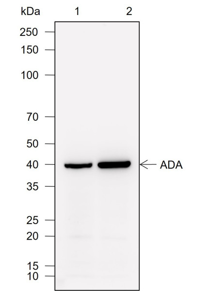 Anti-Recombinant ADA, clone A757