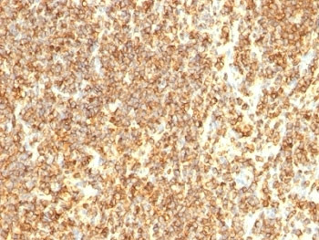 Anti-CD20 (B-cell marker), clone SPM494