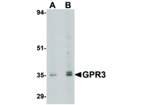 Anti-GPR3