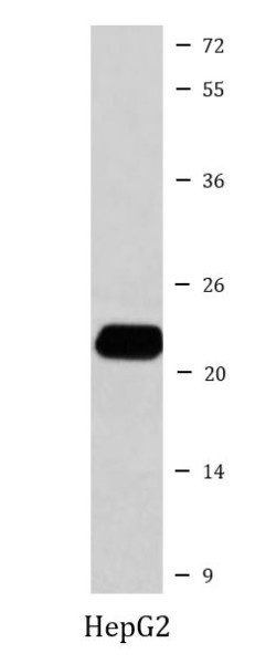 Anti-FTMT / Mitochondrial Ferritin