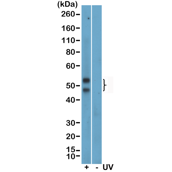 Anti-phospho-JNK1/2/3 (Thr183/Tyr185), Rabbit Monoclonal (RM464)