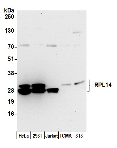 Anti-RPL14/Ribosomal Protein L14