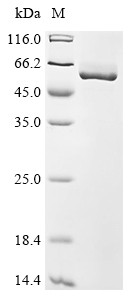 Aldehyde dehydrogenase 1A1 (Aldh1a1), mouse, recombinant