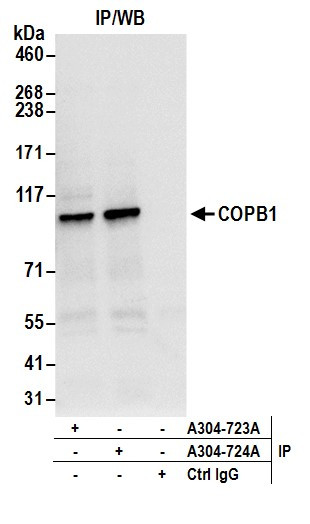 Anti-COPB1