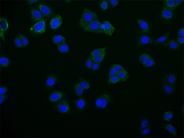 Anti-RAB25 Recombinant Monoclonal, clone 27H3