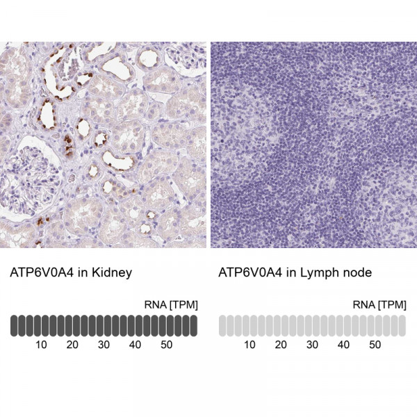 Anti-ATP6V0A4