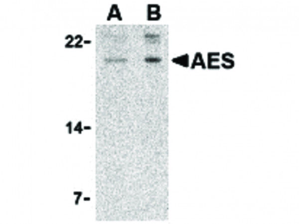 Anti-AES