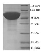 60S ribosomal protein L17 (RPL17), human, recombinant