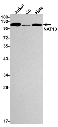 Anti-Recombinant NAT10, clone R05-1C8