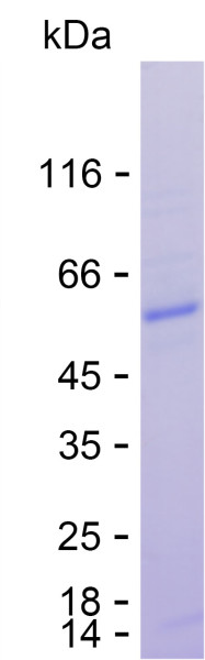 Recombinant Human FOXL3 Protein