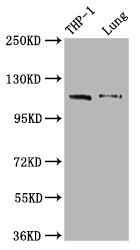Anti-IFIH1 Recombinant Monoclonal, clone 3D12