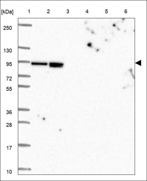 Anti-CTNNAL1