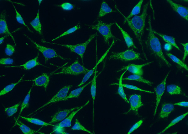Anti-C1QBP/HABP1 Monoclonal Antibody
